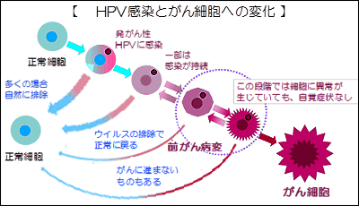 HPV感染とがん細胞への変化
